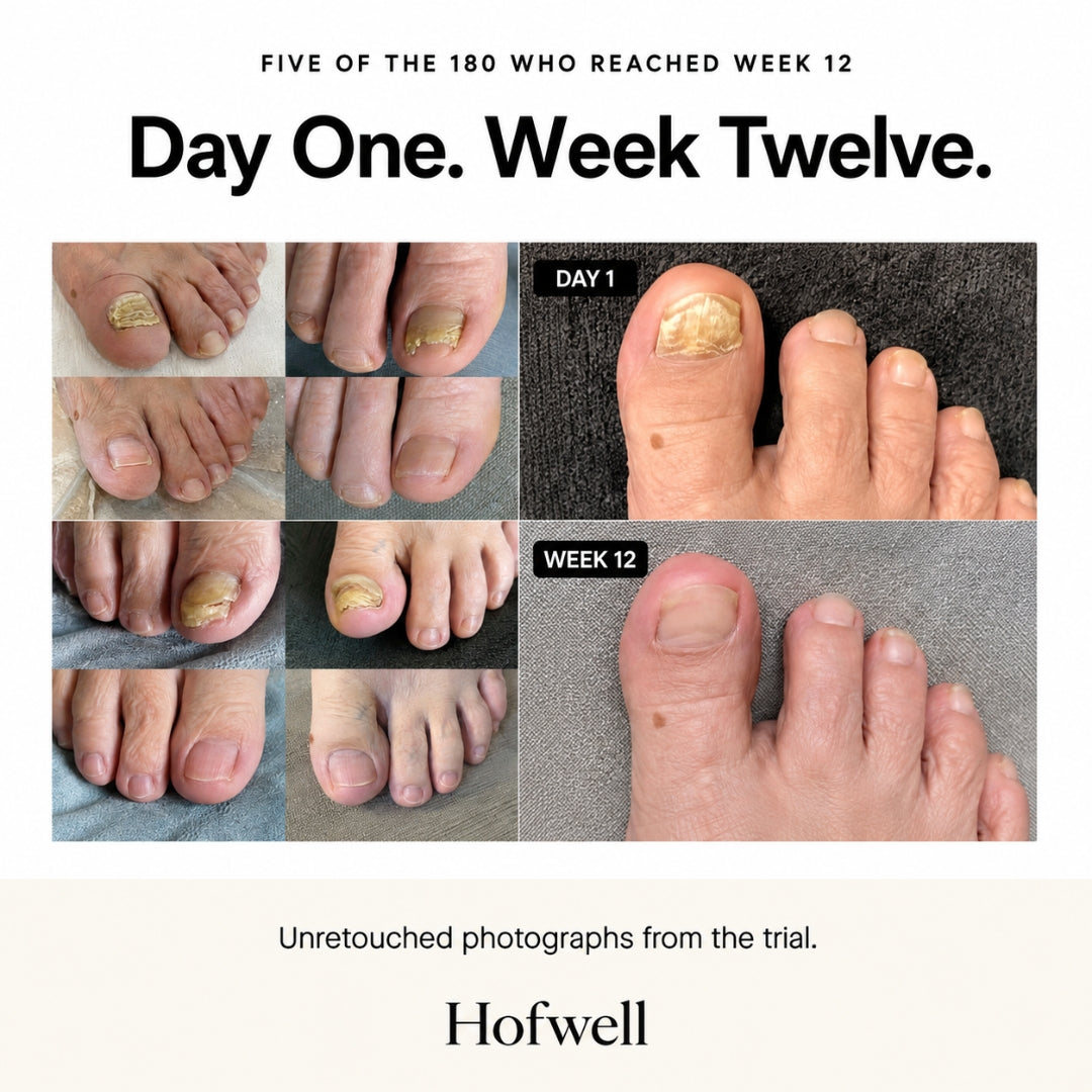 Hofwell Nail Renewal Cream