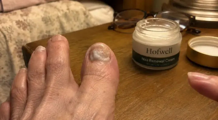 A jar of Hofwell Nail Renewal Cream next to a big toe
