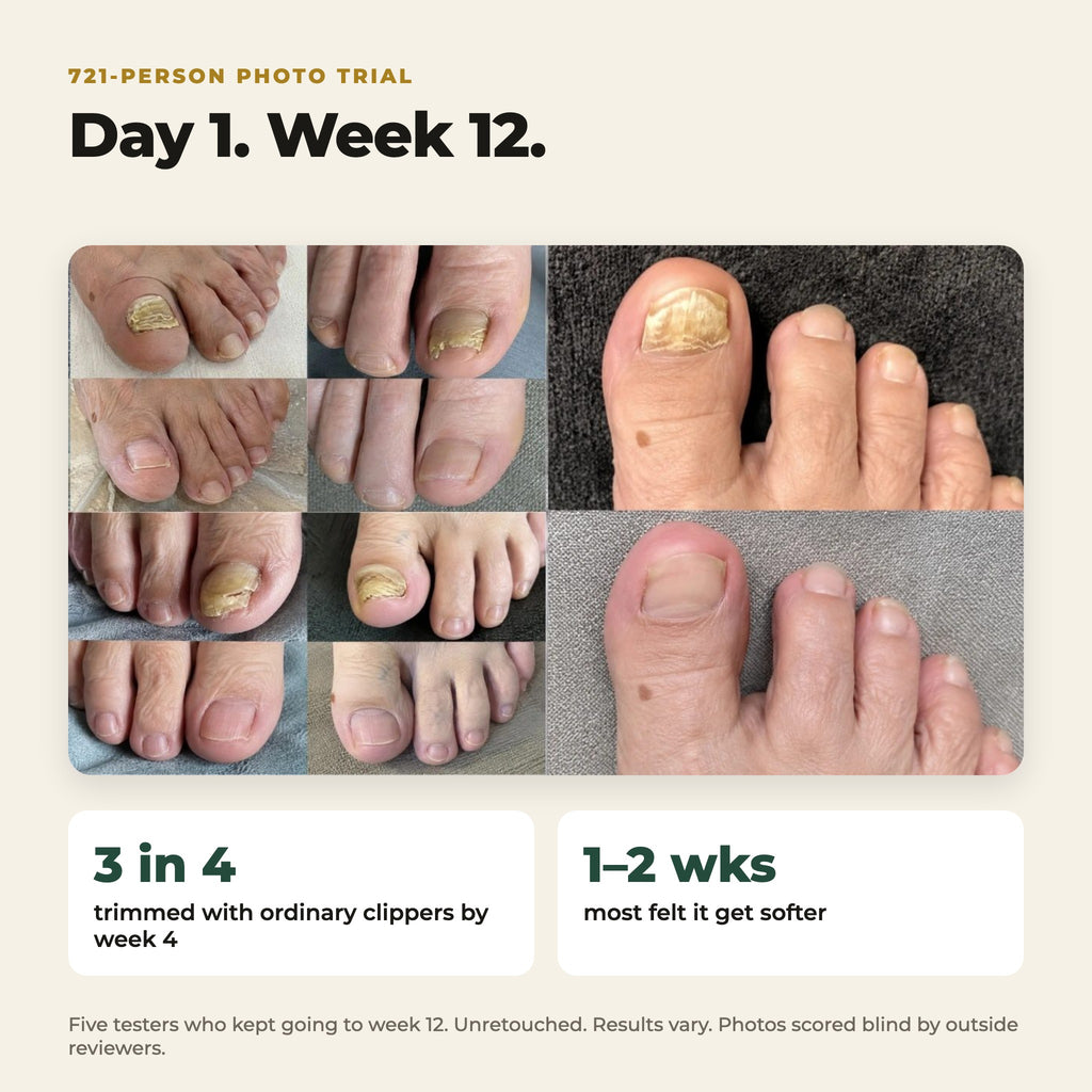 Day 1 and week 12 photos from the 721-person trial. Unretouched. Results vary.